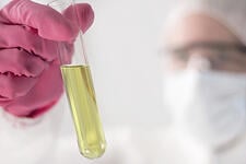 Kidney_Disease_Is_Common