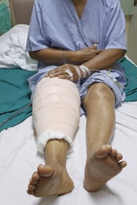 Joint Replacement Surgery