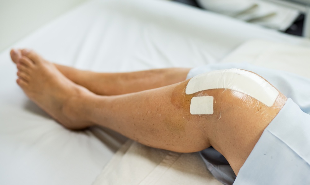 4 Tips to Accelerate Joint Replacement Recovery
